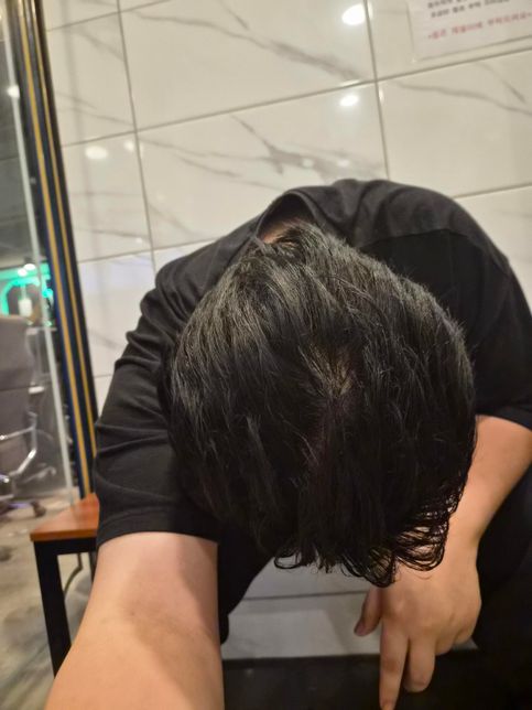 올빽머리를 했을때 정수리 비춤 정도 탈모인지 걱정의 0번 째 이미지