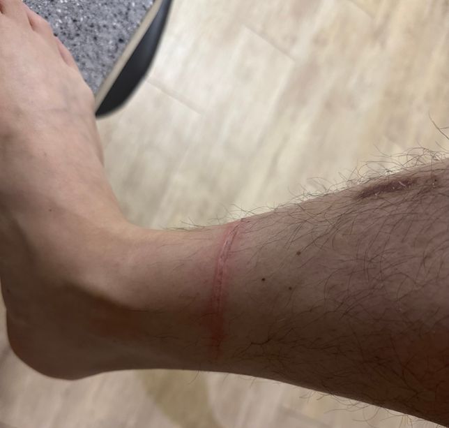 귀가길에 행인의 애완동물 줄에의해서 상처가 생겼어요 보상 가능할까요?의 0번 째 이미지