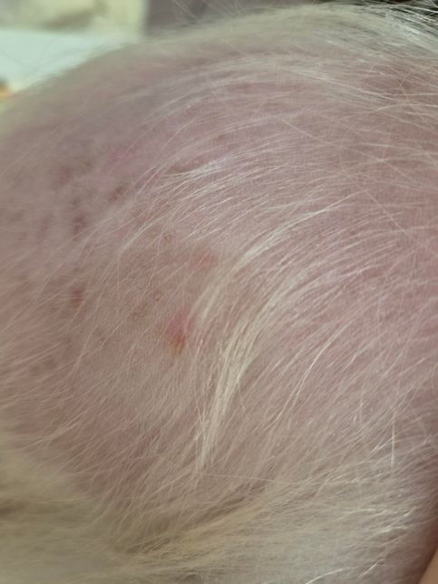 강아지 피부에 모기물린것처럼 핑크색으로 생기는데 그 중심이 모공이예요의 0번 째 이미지