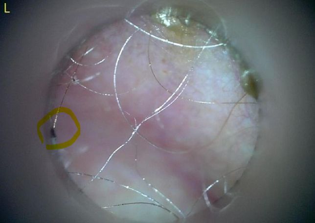 강아지 귀안 검은색 저 부분이 대체 뭘까요?의 2번 째 이미지