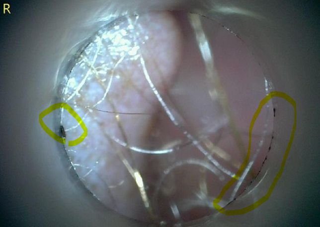 강아지 귀안 검은색 저 부분이 대체 뭘까요?의 0번 째 이미지