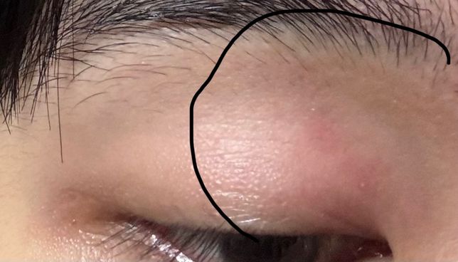 12월 8일에 항히스타민() 처방 받고 남았는데의 0번 째 이미지