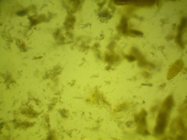 강아지 분변검사에서 간균 이 많다는데.. 이런 경우 치료를 다른 병원들은 어떻게 하나요?의 1번 째 이미지