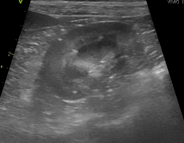 강아지 신장결석 종류 모양만으로는 추측도 불가능한가요?의 1번 째 이미지