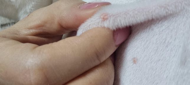 고양이 등에 뭐가 있어요. 알려주세요의 0번 째 이미지