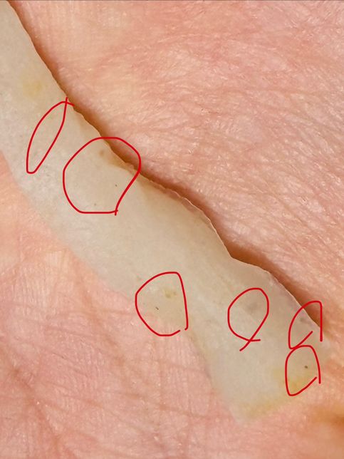 설곤약 중국간식에 들어잇는 이물질..🤮🤮의 1번 째 이미지