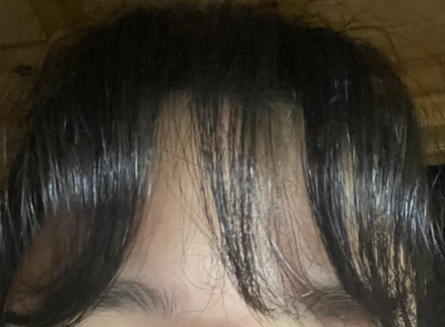 앞머리가 길어서 자꾸 옆으로 휘는걸까요?의 0번 째 이미지