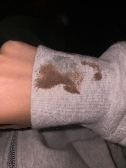 옷에 묻은 얼룩 지우는 법 알려주세요ㅠㅠ의 0번 째 이미지