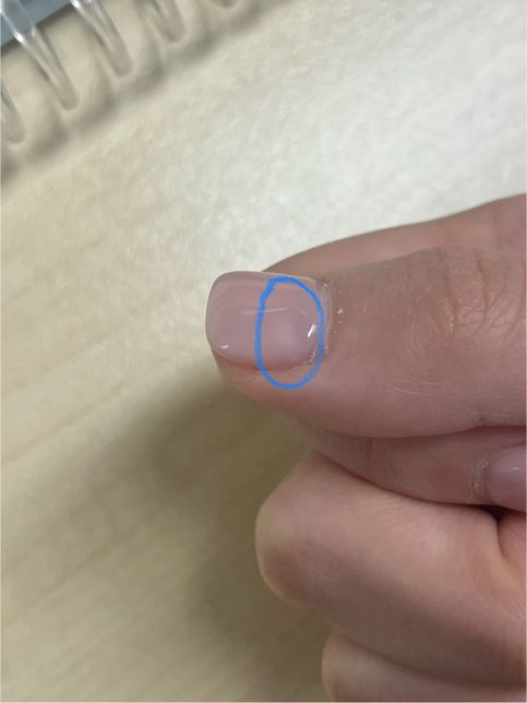 젤네일 미세하게 하얗게 된 부분이 있는데 제거해줘야할까요?의 0번 째 이미지