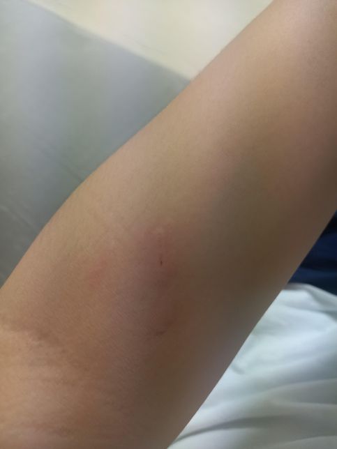 공격성이 너무 심한거 같아요....의 0번 째 이미지