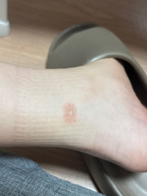 간지럽지도 않고 있는지도 몰랐어요..의 0번 째 이미지