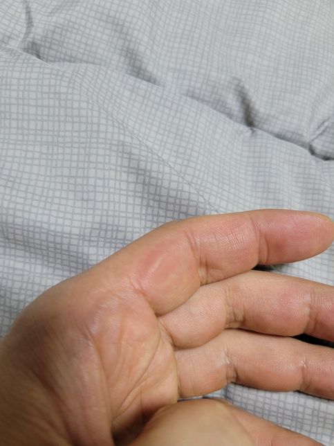 골프치는데 왼쪽 검지와 새끼 손가락에 굳은살이 박힙니다~!의 0번 째 이미지