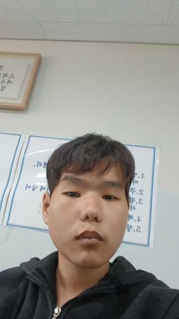 안녕하세요 친구들한테 얼굴이 겁나 못생겼다고 놀림 받는 18살학생에 고민 좀 들어주세요..의 0번 째 이미지