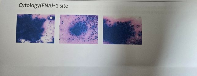 이런경우 무조건 다리절단이 최선인가요?의 2번 째 이미지