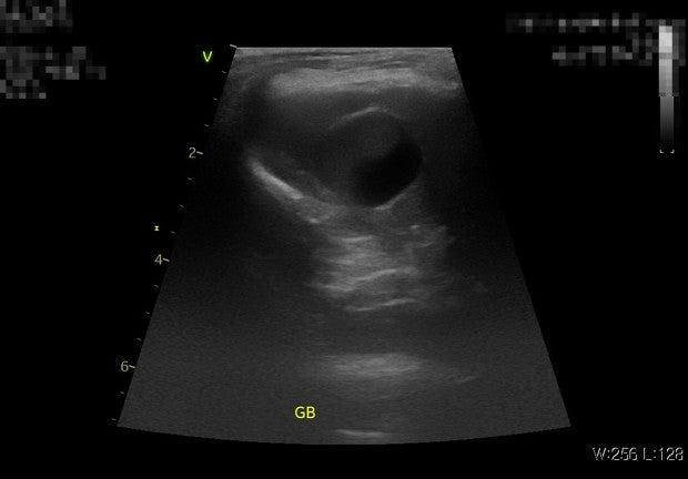 강아지 담낭 한번 봐주시면 감사하겠습니다의 0번 째 이미지