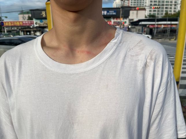 폭행관련 형사접수 및 쌍방이 가능한지의 3번 째 이미지