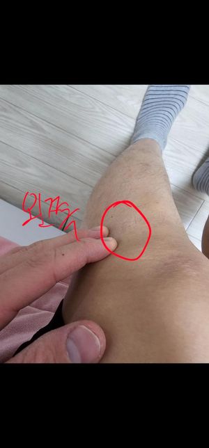 9월10일에 신호등없는횡단보도사고의 1번 째 이미지