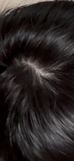 이거 정수리 탈모인가요 걱정되서 올려봅니다의 1번 째 이미지