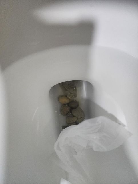 35개월 아기대변 색깔이 밝은회색 빛이돌아요의 0번 째 이미지