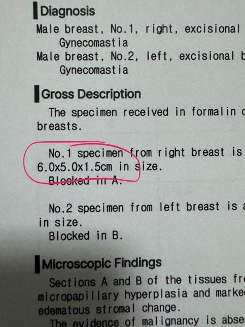 여유증 수술 후 보험 서류 궁금한게있습니다의 0번 째 이미지
