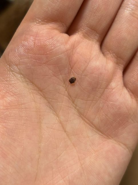 강아지 눈 점막 위에 점?같은 게 떨어졌는데 이게 뭘까요?ㅠㅠ의 0번 째 이미지