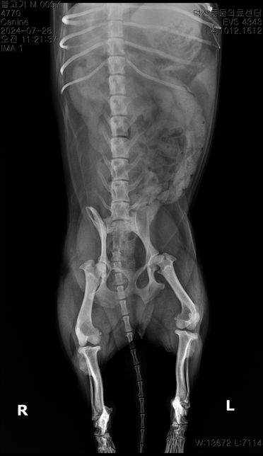 순차적으로 고관절 에 관해 봐주시기 부탁드립니다.의 2번 째 이미지