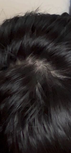 이거 정수리 탈모인가요 걱정되서 올려봅니다의 0번 째 이미지