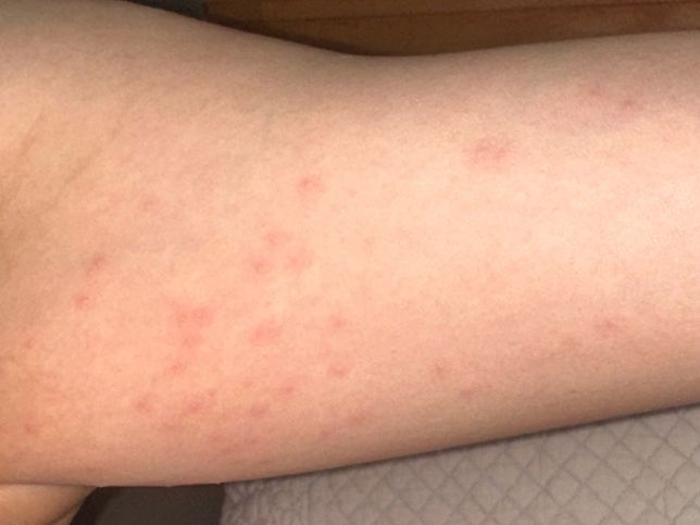 빈대 배설물인지 봐주세요 ㅠㅠ 너무 불쾌하네요의 1번 째 이미지