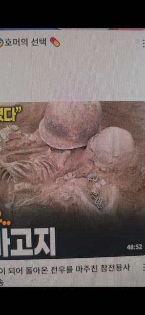 컴퓨터 모니터 이상해요 스크롤 하면 화면이 색상이 약간 변하면서 움직여요의 1번 째 이미지