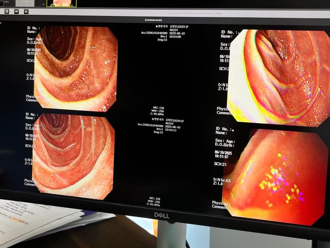 십이지장염증과 역류성식도염...의 0번 째 이미지