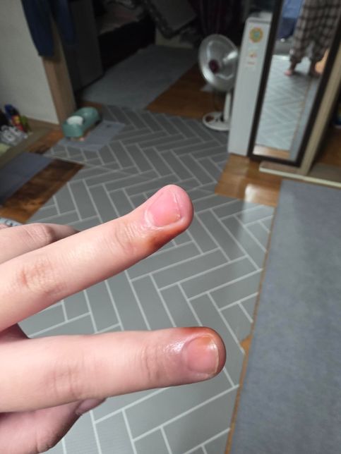 이 정도면 담배.. 끊어야할까요??의 0번 째 이미지