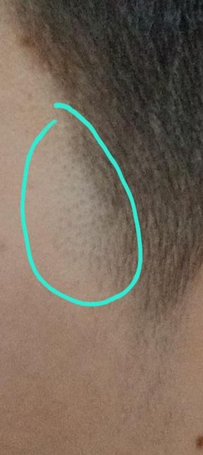 털 정리하다가 면도기로 구렛나루를 살짝 잘라버렸습니다의 0번 째 이미지