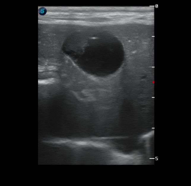 강아지 간수치 상승 원인이 대체 뭘까요 ㅜㅜ의 1번 째 이미지