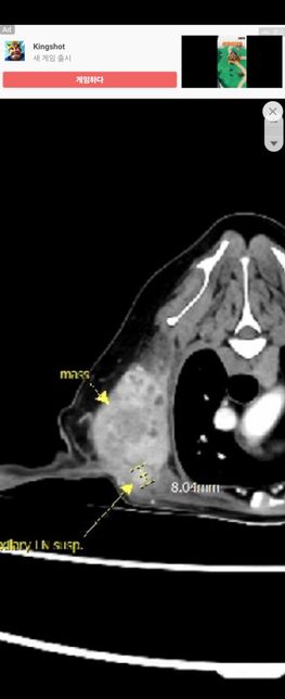 강아지 세포검사 칼시노마, 조직검사 침윤성지방종이래요의 0번 째 이미지