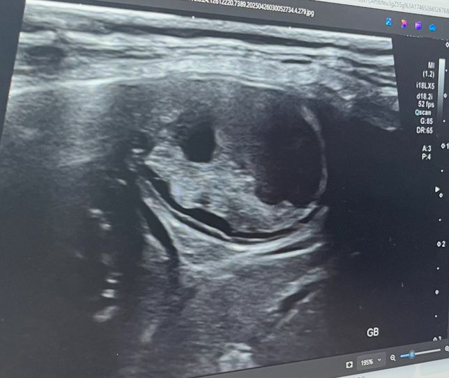 강아지 담낭 사진 담낭점액종인가요?의 0번 째 이미지