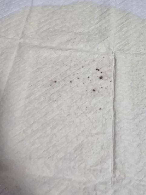 강아지 오줌에 피같은게 섞여나온 것 같아요 ㅠㅜ의 0번 째 이미지