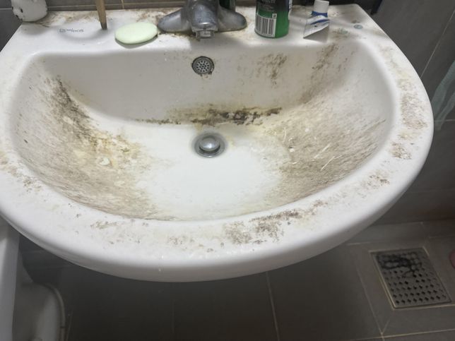사진에 보이는 거 없애는 방법 알려주세요의 0번 째 이미지
