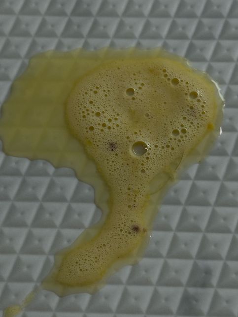 강아지 혈토인가요????????의 1번 째 이미지