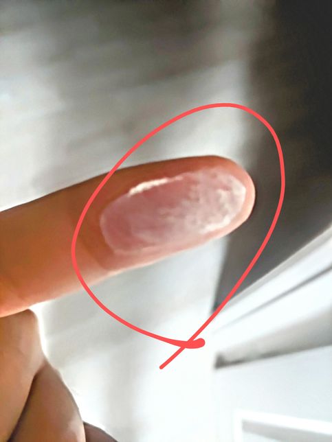 빨간 동그라미 부분 만져서 손에 흰 페인트가루묻었는데 피부에 안좋나요?의 2번 째 이미지
