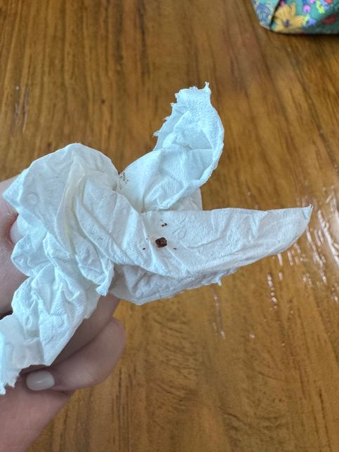 이 벌레 뭔가요? 급해요 알려주세용 ㅠㅠ의 2번 째 이미지