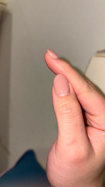 젤 네일 바른 검지손톱 측면에 검은부분 왜이러나요 곰팡이 인가요의 1번 째 이미지