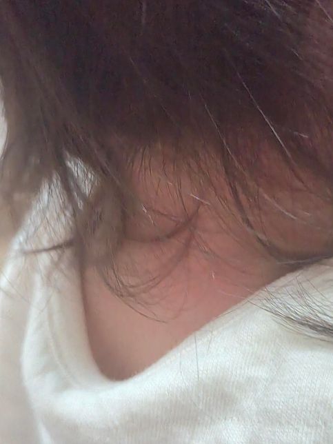 아기 음식 먹고 얼굴, 머리(두피), 목 을 긁어요의 1번 째 이미지
