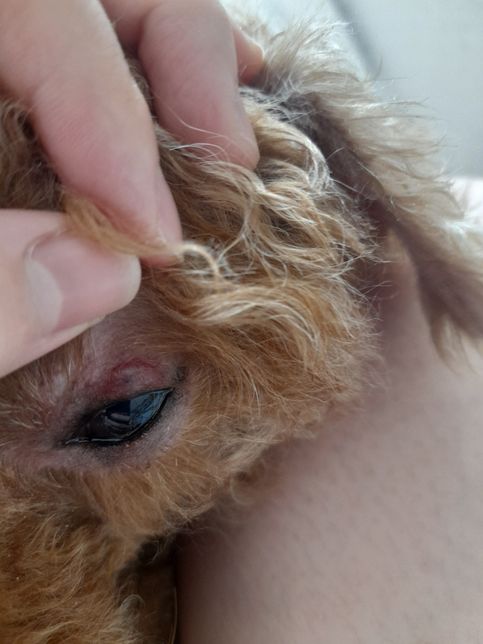 눈꺼풀위에 빨간물집?혹같은게 갑자기 생겼는데 왜그럴까요?의 0번 째 이미지