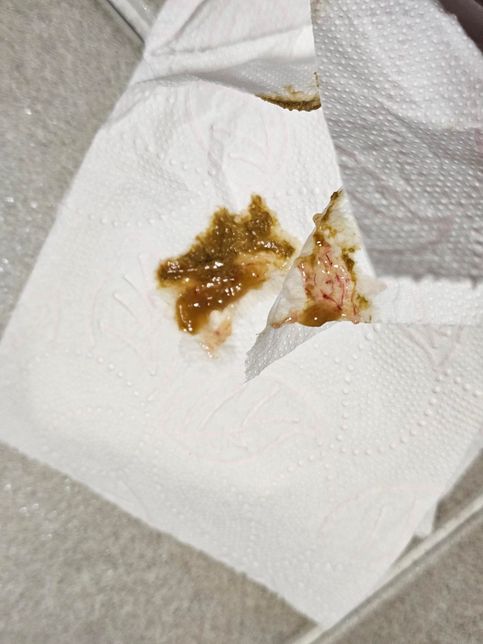 (사진주의)노견 강아지가 설사를 하는데 병원가야할까요?의 2번 째 이미지