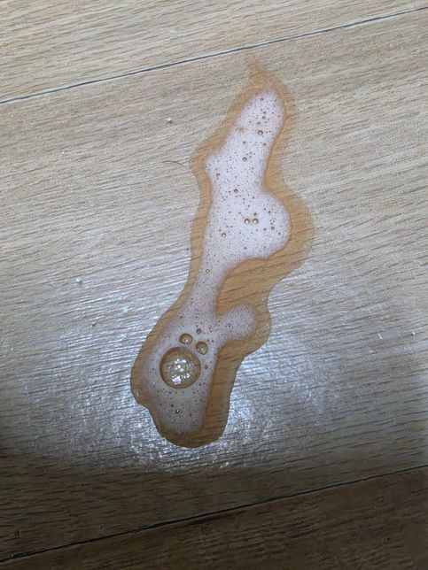 냥이 토에서 붉그스름한 토가 나와요 봐주세요ㅠ의 0번 째 이미지