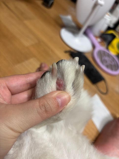 발가락 사이 뭔가 났는데 조직검사까지 해야되나요?의 0번 째 이미지