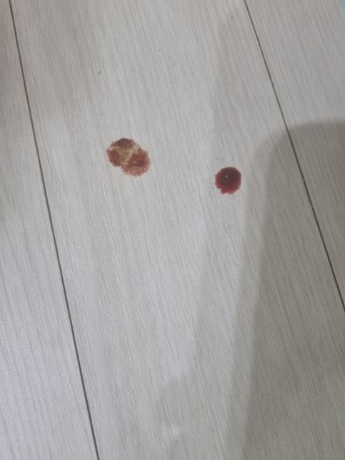 강아지가 혈변을 봐요(사진첨부 했습니다. 좀 더러워요)의 1번 째 이미지