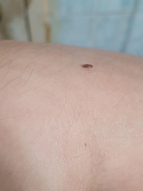 이 벌레 이름이 뭔가요?해충인가요?의 1번 째 이미지