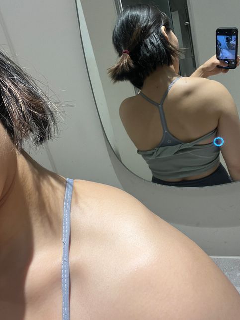 운동 관련 질문 승모근 ,,ㅜㅜ 한번 봐주세여의 1번 째 이미지