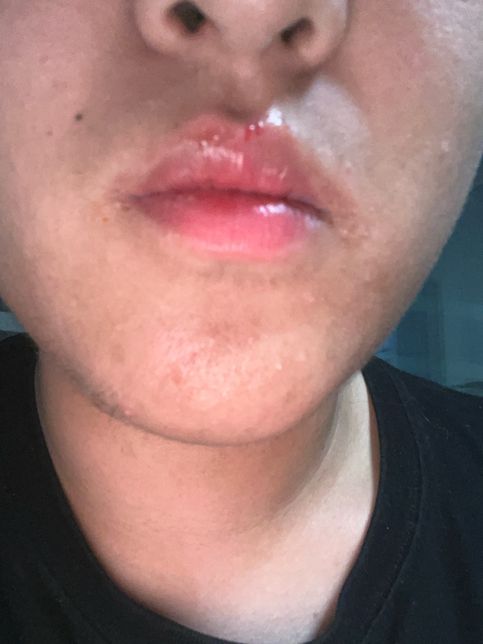 파상품 질문입나다 녹슨 면도기날에 베임의 0번 째 이미지